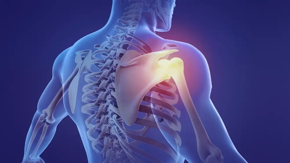Understanding Total Shoulder Joint Replacement Surgery at NASC in Nashua, NH