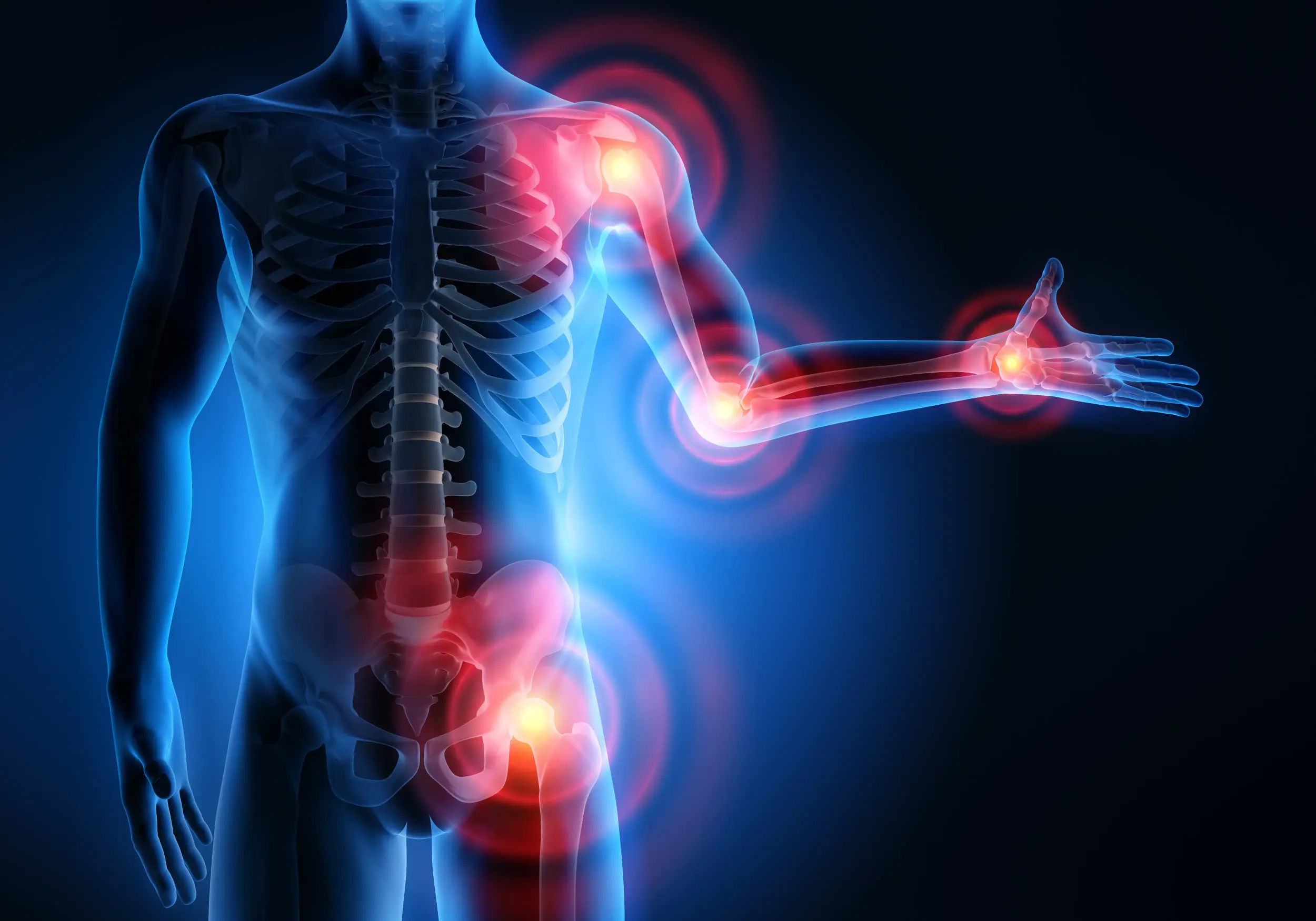 Arthritis and Joint Pain